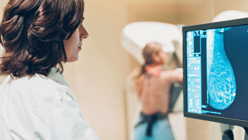 ¿Qué es una mamografía?